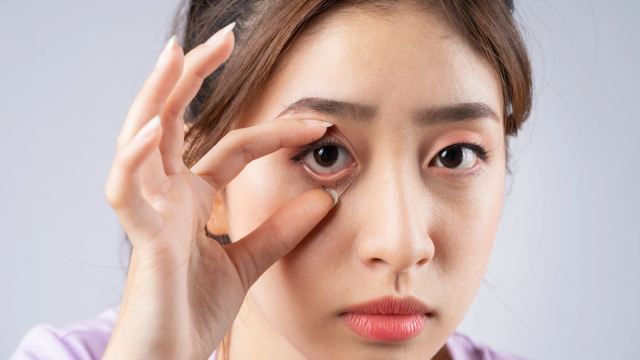 Penyebab Mata Katarak yang Perlu Kita Waspadai Sebelum Terlambat